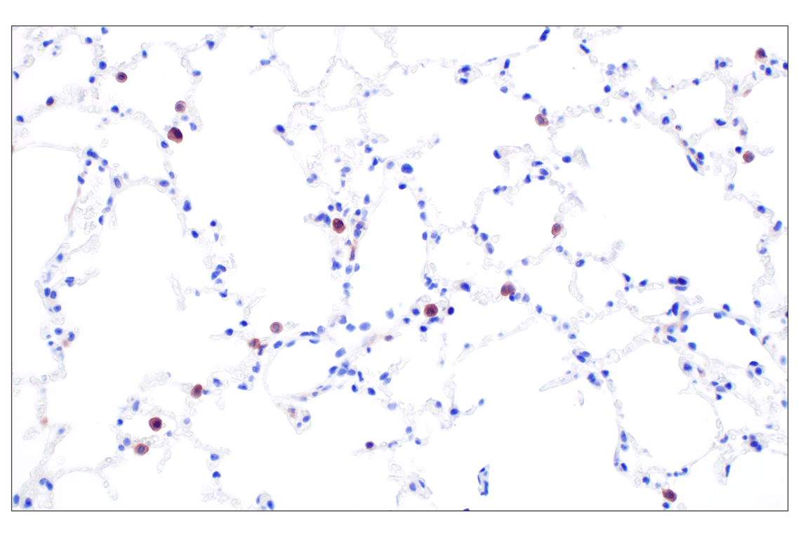 Immunohistochemistry Image 5: Dectin-1/ Clec7a (E3P5W) Rabbit Monoclonal Antibody