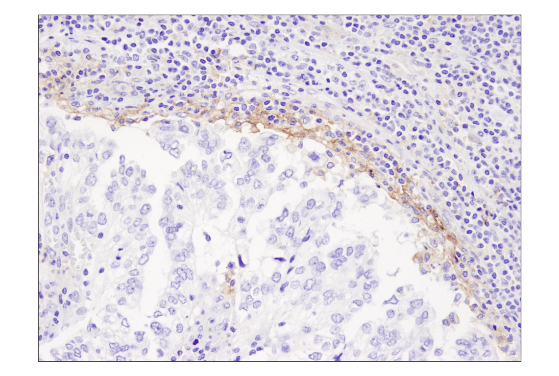Immunohistochemistry Image 5: PD-L1 (405.9A11) Mouse Monoclonal Antibody (BSA and Azide Free)