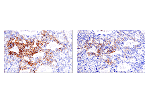 Immunohistochemistry Image 10: NCAM1 (CD56) (E7X9M) Rabbit Monoclonal Antibody (BSA and Azide Free)