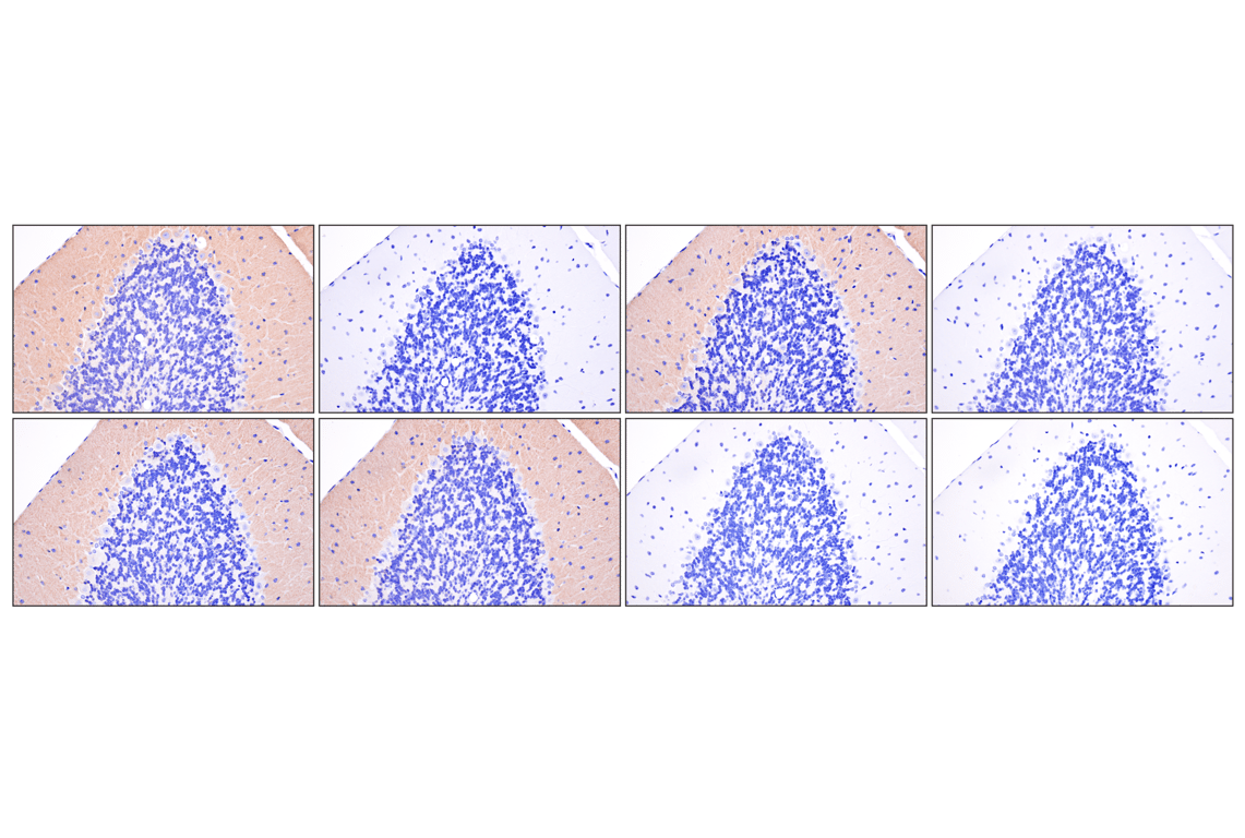 Immunohistochemistry Image 5: Phospho-Tau (Ser396) (F3S9T) Rabbit Monoclonal Antibody