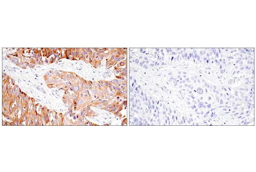 Immunohistochemistry Image 7: Transferrin Receptor/CD71 (10F11) Mouse Monoclonal Antibody