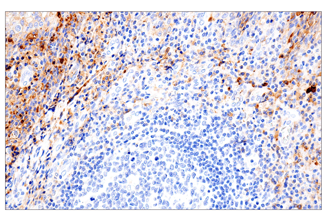Immunohistochemistry Image 9: Syndecan 1 (E7F7T) Rabbit Monoclonal Antibody