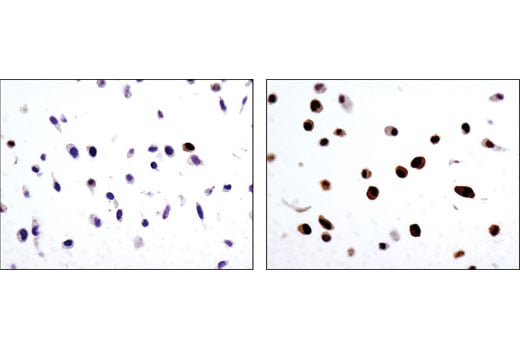 Immunohistochemistry Image 3: Phospho-p90RSK (Ser380) (D3H11) Rabbit Monoclonal Antibody (BSA and Azide Free)