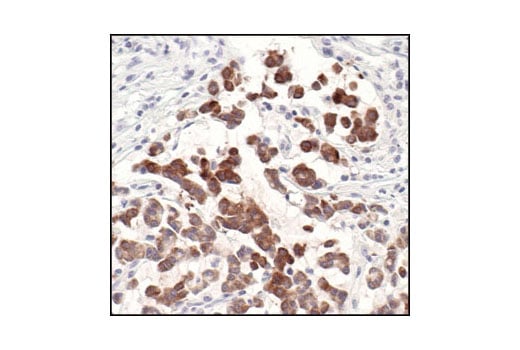 Immunohistochemistry Image 2: MUC1 (VU4H5) Mouse Monoclonal Antibody (BSA and Azide Free)