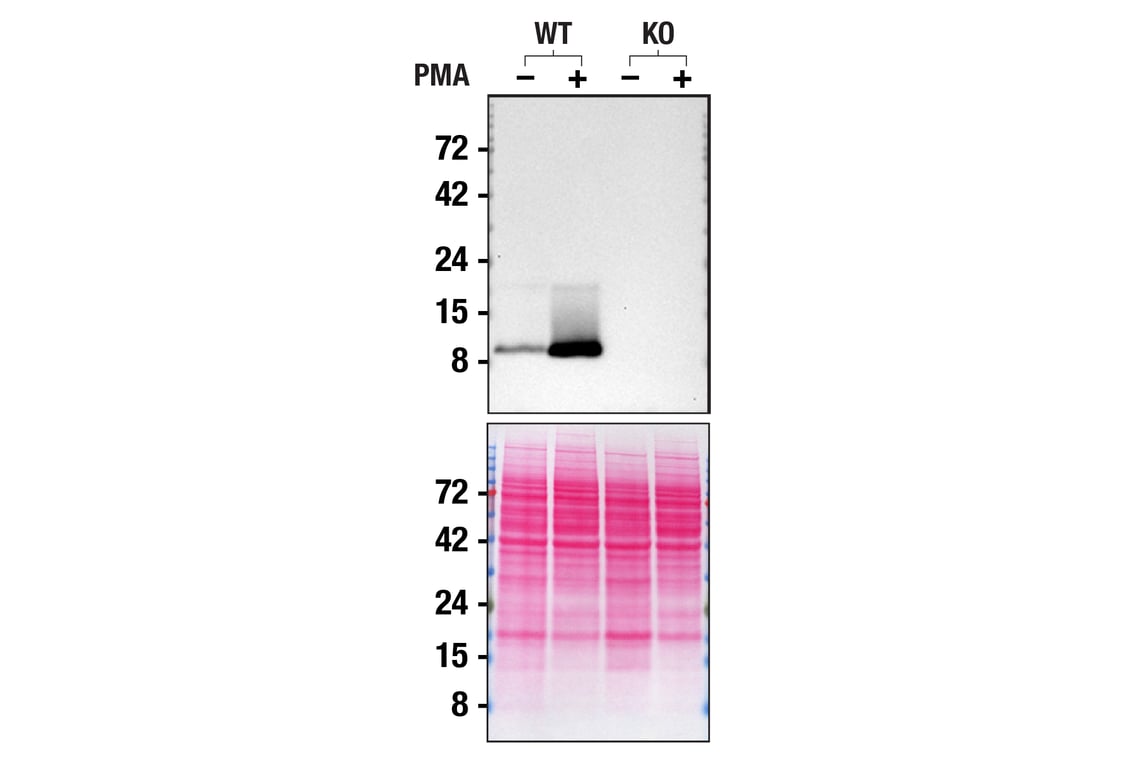 Western Blotting Image 2: FcR gamma (E6Y1A) Rabbit Monoclonal Antibody
