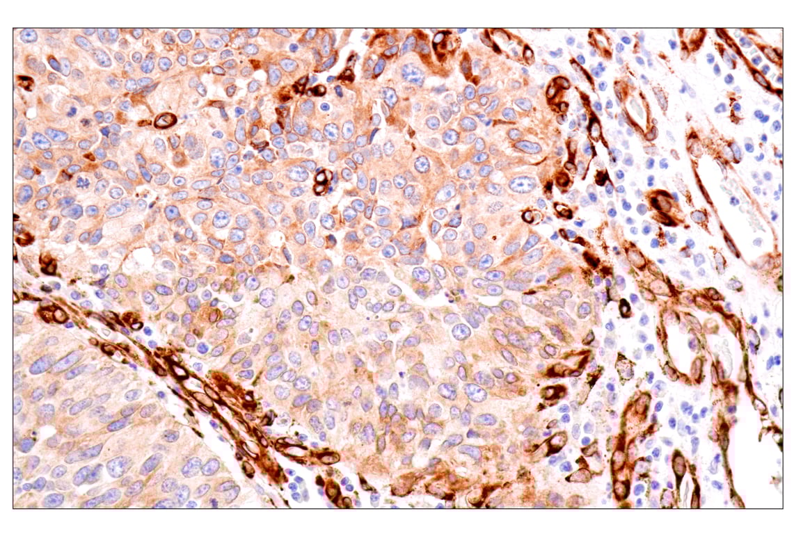 Immunohistochemistry Image 4: HSP47/SERPINH1 (E4A8P) Rabbit Monoclonal Antibody