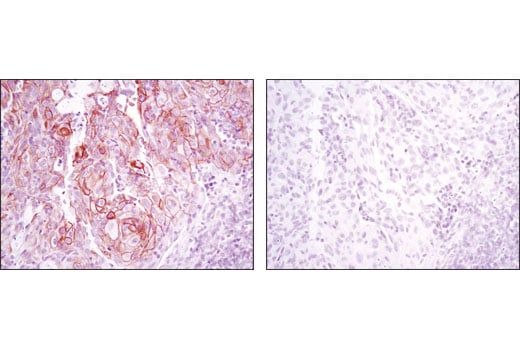 Immunohistochemistry Image 5: Phospho-HER3/ErbB3 (Tyr1289) (D1B5) Rabbit Monoclonal Antibody
