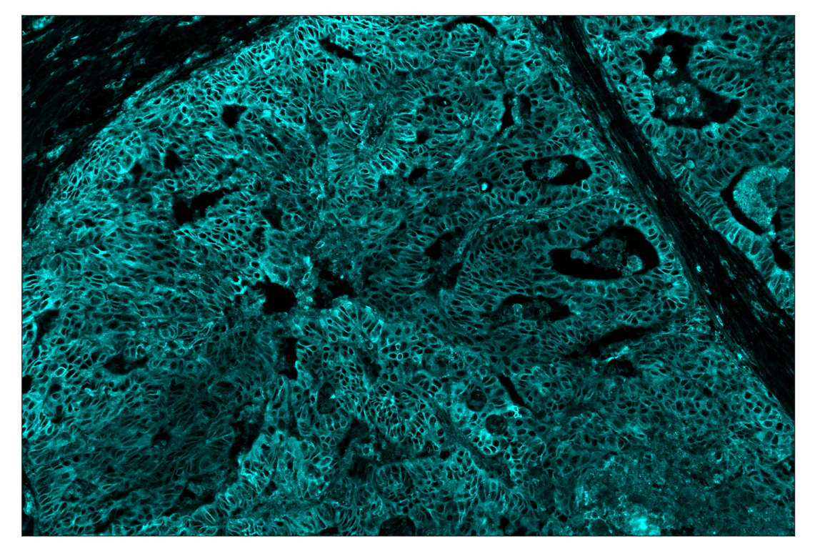 Immunohistochemistry Image 5: MHC Class I (EMR8-5) & CO-0082-647 SignalStar<sup>™</sup> Oligo-Antibody Pair