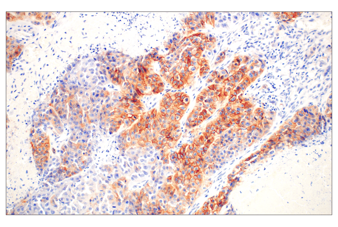Immunohistochemistry Image 1: EGF Receptor (D38B1) Rabbit Monoclonal Antibody