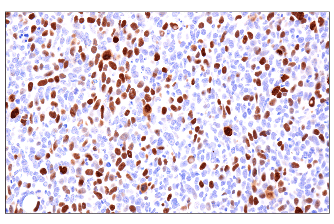 Immunohistochemistry Image 12: Phospho-NPM1 (Thr199) (E4C7S) Rabbit Monoclonal Antibody