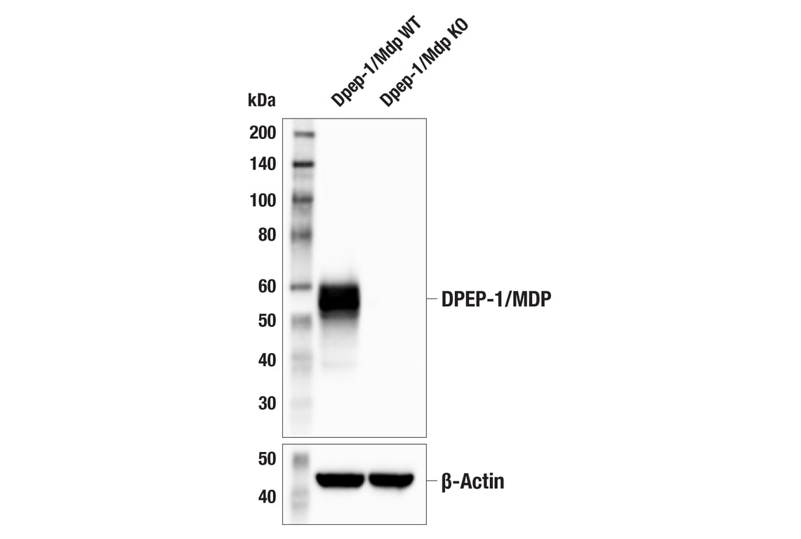 Western Blotting Image 1: DPEP-1/MDP (E5H7T) Rabbit mAb