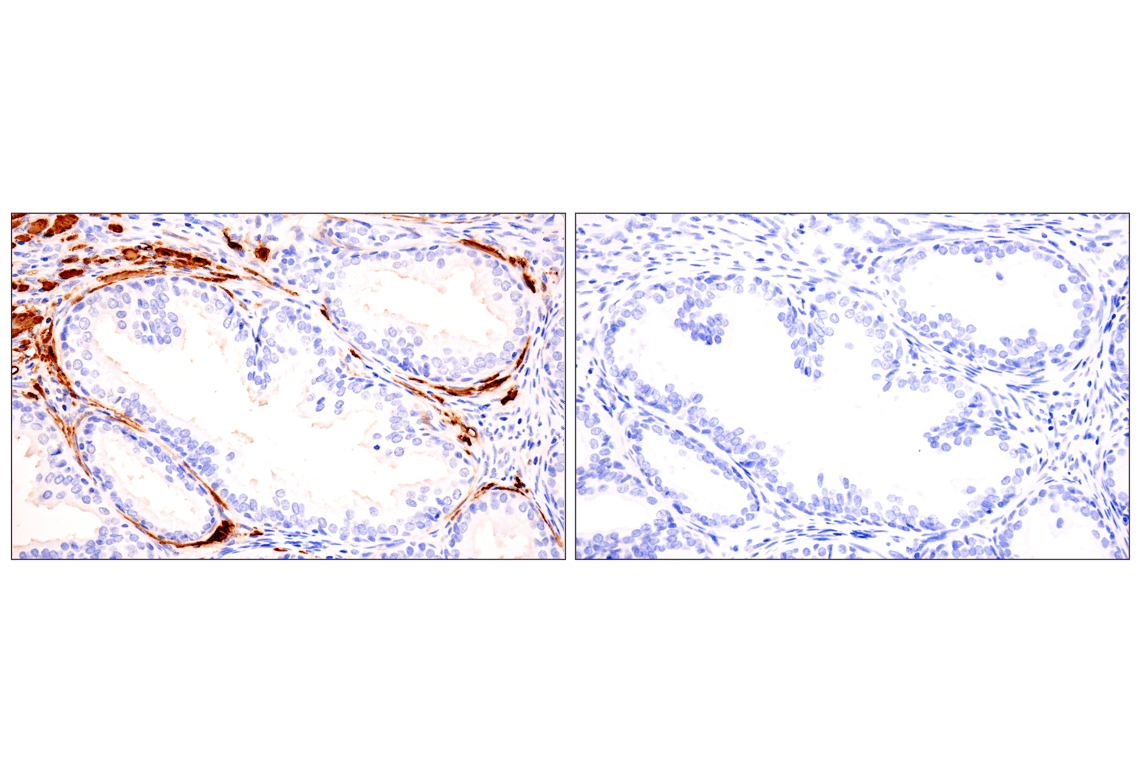 Immunohistochemistry Image 16: Transgelin/TAGLN (F3B7H) Rabbit Monoclonal Antibody