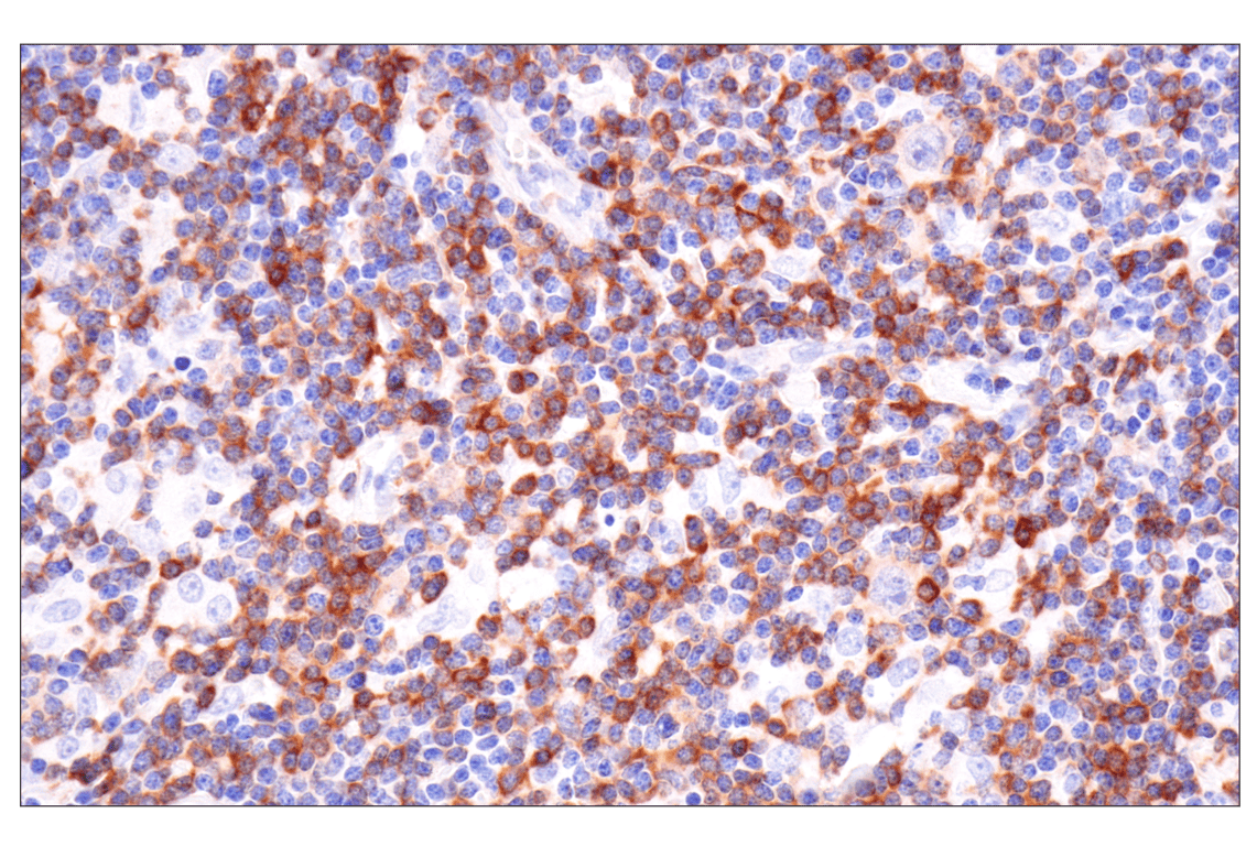 Immunohistochemistry Image 5: SPAK (F7T1K) Rabbit Monoclonal Antibody