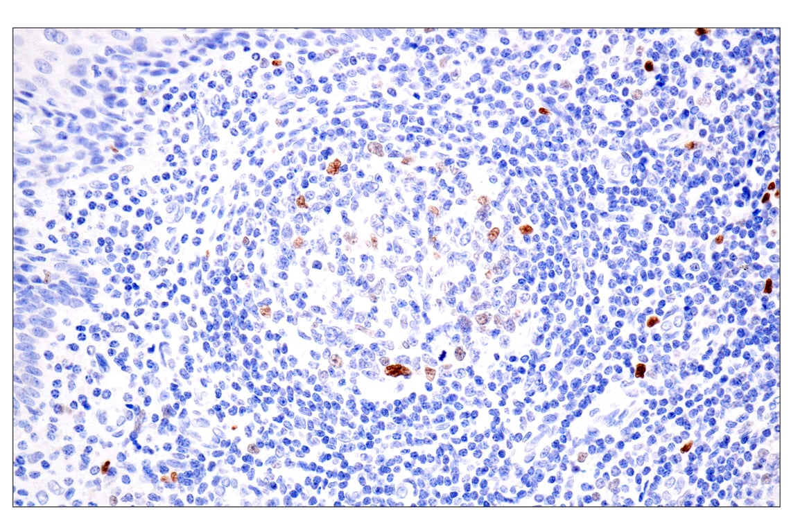 Immunohistochemistry Image 6: BATF3 (E3F3L) Rabbit Monoclonal Antibody (BSA and Azide Free)