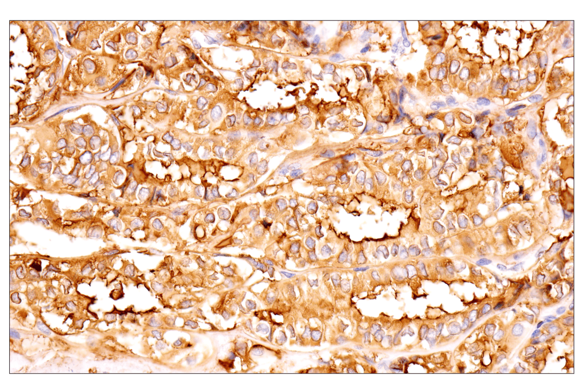 Immunohistochemistry Image 3: Thyroglobulin (F5O9B) Rabbit Monoclonal Antibody