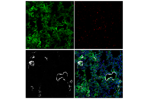 LYVE-1 (E3L3V) Rabbit mAb (Alexa Fluor® 488 Conjugate