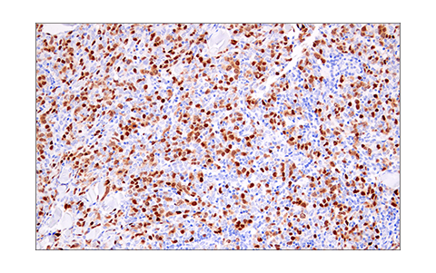 Immunohistochemistry Image 6: Geminin (E5Q9S) XP<sup>®</sup> Rabbit mAb (BSA and Azide Free)