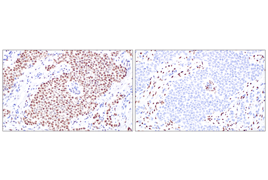 Immunohistochemistry Image 2: WT1 (F3T7B) Rabbit Monoclonal Antibody (Carboxy-terminal Antigen)
