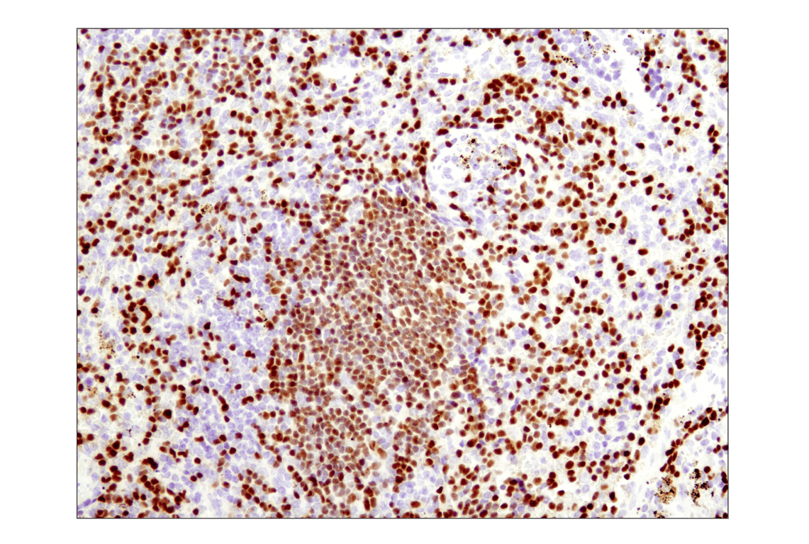 Immunohistochemistry Image 3: PAX5 (D7H5X) Rabbit Monoclonal Antibody