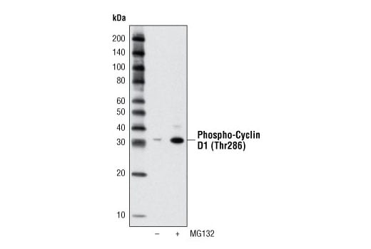 Western Blotting Image 2: Phospho-Cyclin D1 (Thr286) (D29B3) Rabbit Monoclonal Antibody (BSA and Azide Free)