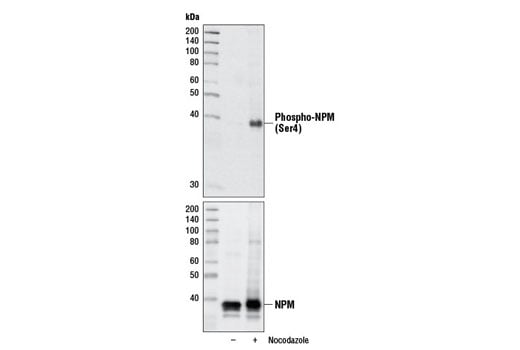 undefined Image 2: Nocodazole