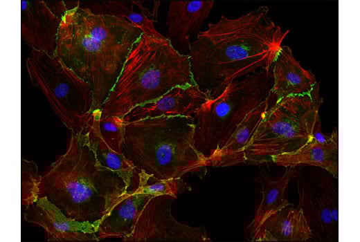 Immunofluorescence Image 2: DAPI