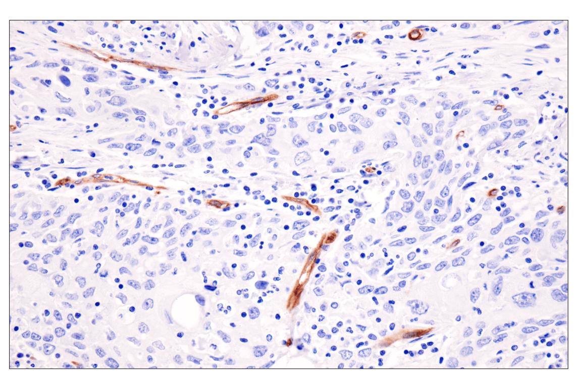 Immunohistochemistry Image 4: ESAM (F2Y5Q) Rabbit Monoclonal Antibody