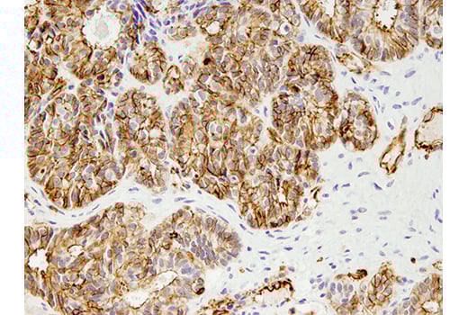 Immunohistochemistry Image 2: Phospho-Ezrin (Thr567)/Radixin (Thr564)/Moesin (Thr558) (48G2) Rabbit Monoclonal Antibody (BSA and Azide Free)