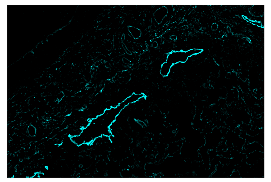Immunohistochemistry Image 5: NT5E/CD73 (D7F9A) & CO-0039-594 SignalStar<sup>™</sup> Oligo-Antibody Pair