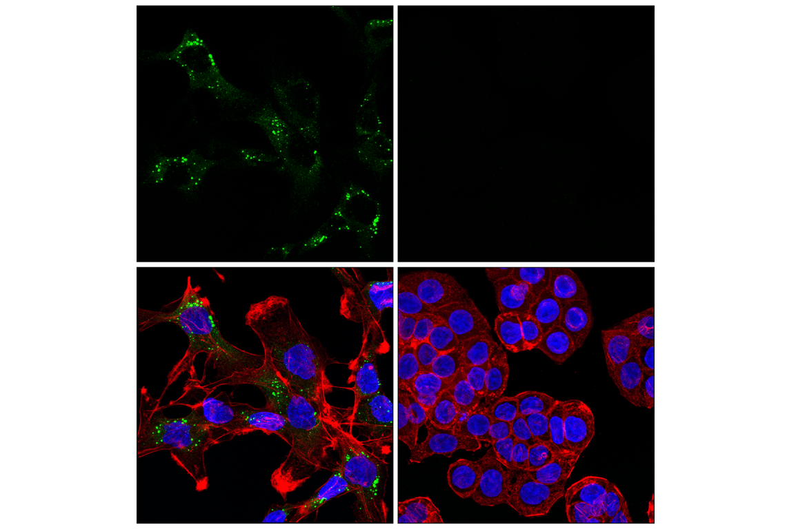 Immunofluorescence Image 1: COL7A1 (F4Q8A) Rabbit Monoclonal Antibody