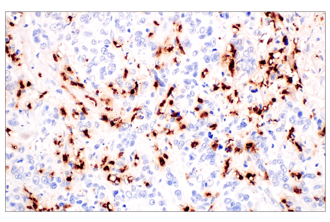 Immunohistochemistry Image 4: Neutrophil Elastase (F4H3X) Rabbit Monoclonal Antibody