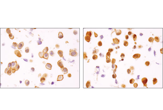 Immunohistochemistry Image 1: Akt1 (D9R8K) Rabbit Monoclonal Antibody