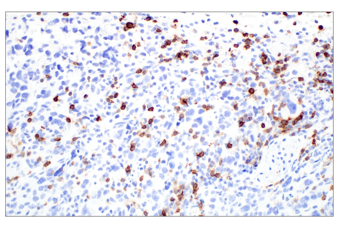 Immunohistochemistry Image 1: CD6 (E9Q1V) Rabbit Monoclonal Antibody