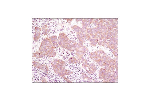 undefined Image 9: mTOR Regulation Antibody Sampler Kit