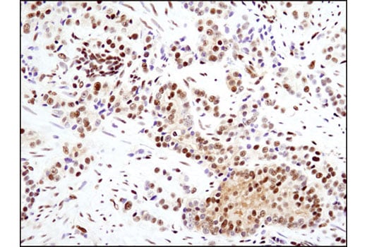 Immunohistochemistry Image 5: Glucocorticoid Receptor (D6H2L) Rabbit Monoclonal Antibody