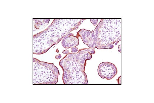 Immunohistochemistry Image 4: EGF Receptor (D38B1) Rabbit Monoclonal Antibody (BSA and Azide Free)