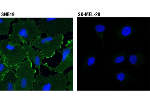 Immunofluorescence Image 1: EphA2 (8B6) Mouse Monoclonal Antibody
