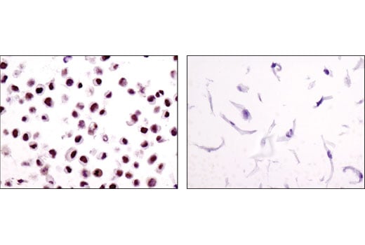 Immunohistochemistry Image 3: ERCC1 (D6G6) Rabbit Monoclonal Antibody