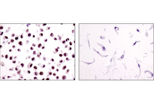 Immunohistochemistry Image 3: ERCC1 (D6G6) XP<sup>®</sup> Rabbit mAb