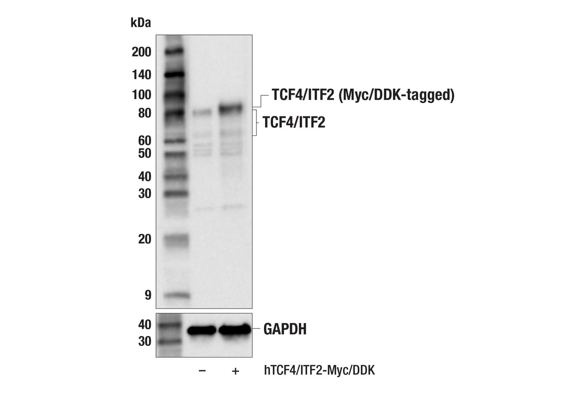 Western Blotting Image 3: TCF4/ITF2 (E3X2Y) Rabbit Monoclonal Antibody