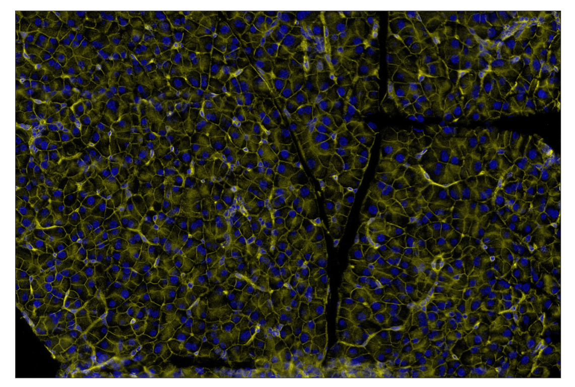 Immunohistochemistry Image 3: CD47 (E2V9V) & CO-0141-647 SignalStar<sup>™</sup> Oligo-Antibody Pair
