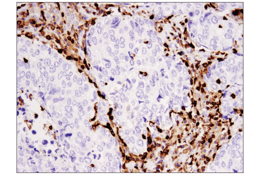 Immunohistochemistry Image 3: Coronin 1A (D6K5B) XP<sup>®</sup> Rabbit mAb