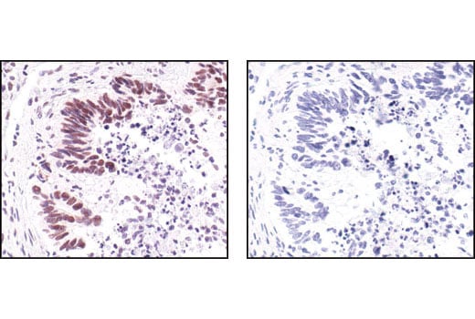 Immunohistochemistry Image 3: Survivin (71G4B7) Rabbit Monoclonal Antibody (BSA and Azide Free)