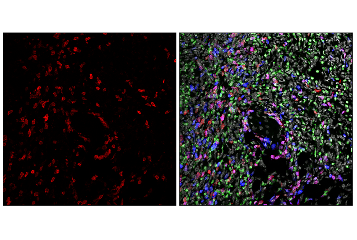 Immunofluorescence Image 1: CD27 (F3R2V) Rabbit Monoclonal Antibody