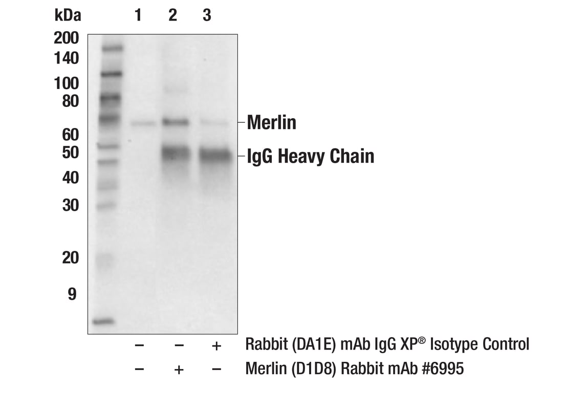Immunoprecipitation Image 1: Merlin (D1D8) Rabbit Monoclonal Antibody