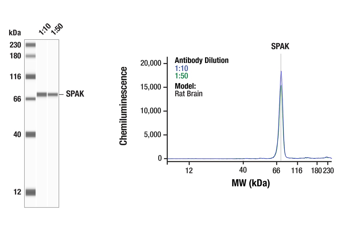 Western Blotting Image 1: SPAK (F7T1K) Rabbit Monoclonal Antibody
