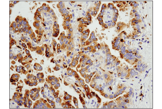 Immunohistochemistry Image 3: Legumain (D6S4H) Rabbit Monoclonal Antibody (BSA and Azide Free)