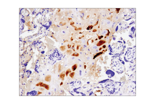 Immunohistochemistry Image 4: IGFBP1 (D4E9T) Rabbit Monoclonal Antibody