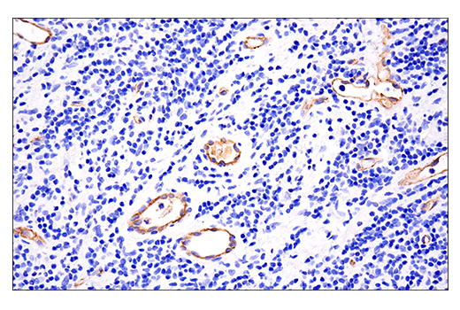 Immunohistochemistry Image 4: VE-Cadherin (E6N7A) Rabbit Monoclonal Antibody (BSA and Azide Free)