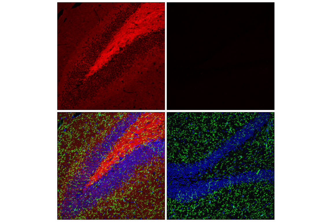 Immunofluorescence Image 2: Tau (E5O2W) Rabbit Monoclonal Antibody